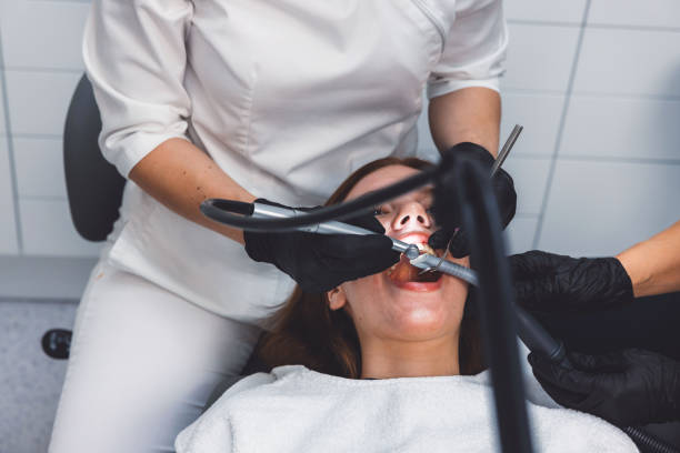 Best Dental Abscess Treatment in San Jose, CA